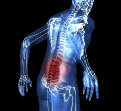 Сильная боль в спине симптом кисты позвоночника